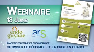 Webinaire : Imagerie pelvienne et endométriose – optimiser le dépistage et la prise en charge